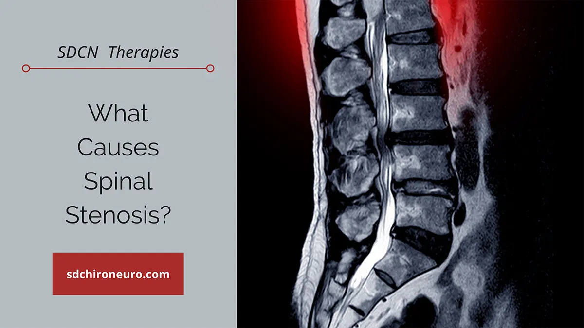 Close up on spinal stenosis