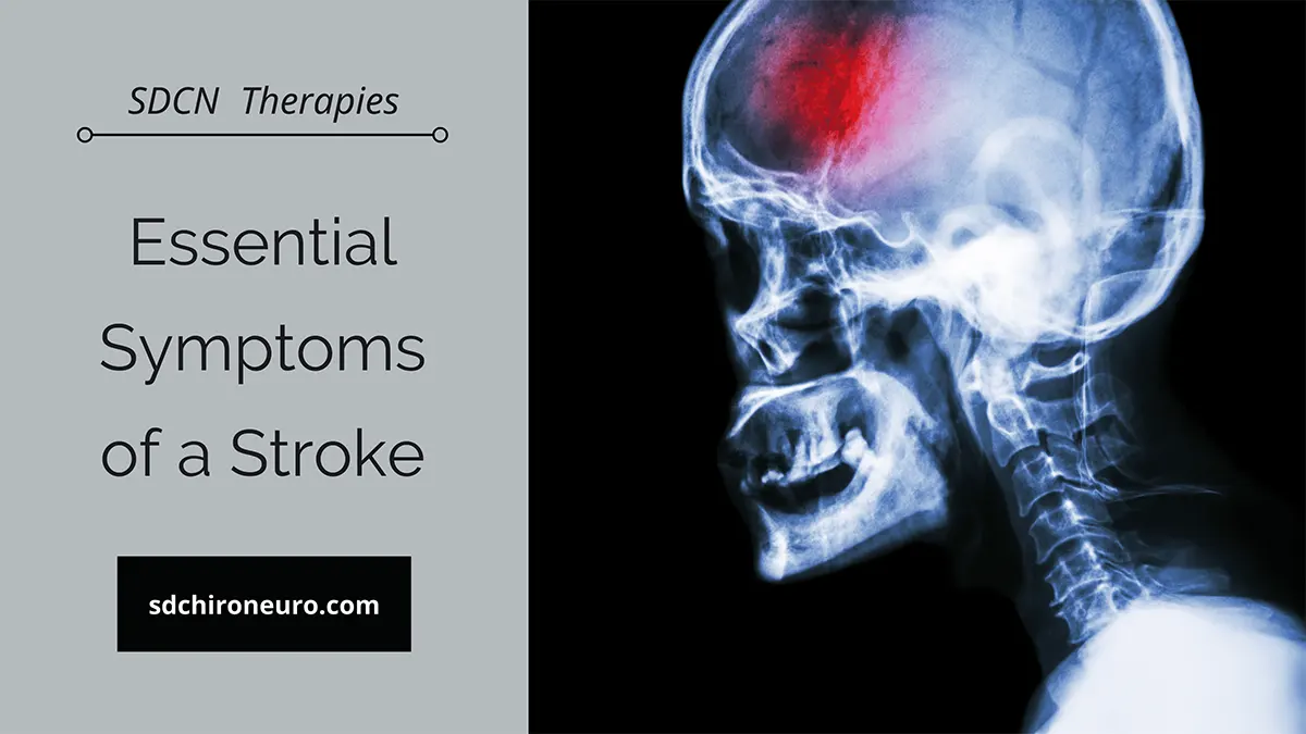 symptoms of stroke